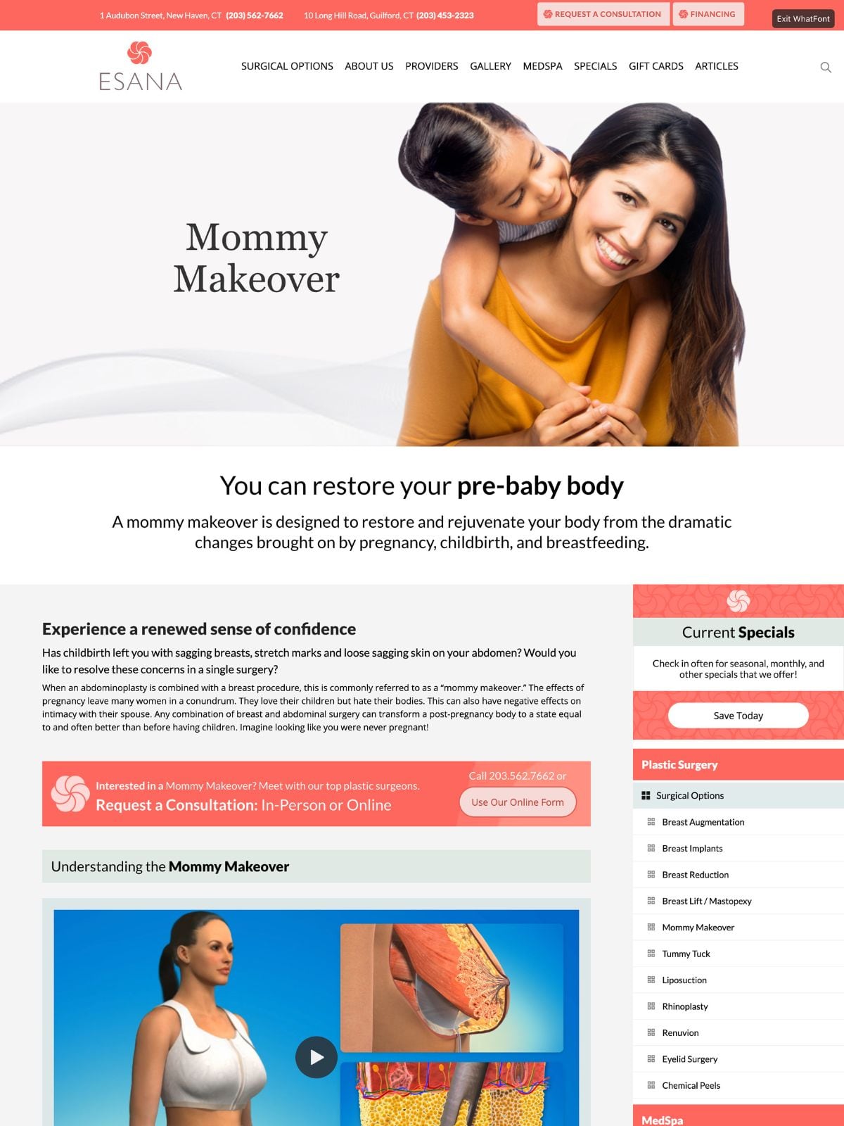 ESANA-Mommy Makeovers